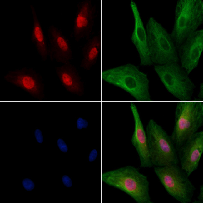 SFRS18 Antibody in Immunocytochemistry (ICC/IF)