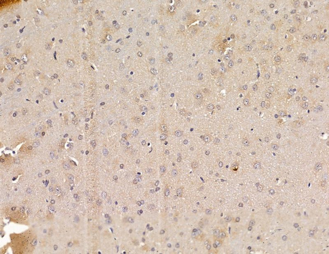 SRSF9 Antibody in Immunohistochemistry (Paraffin) (IHC (P))