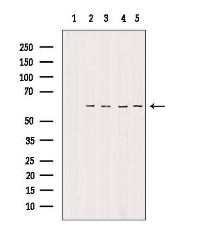 TIGD2 Antibody in Western Blot (WB)