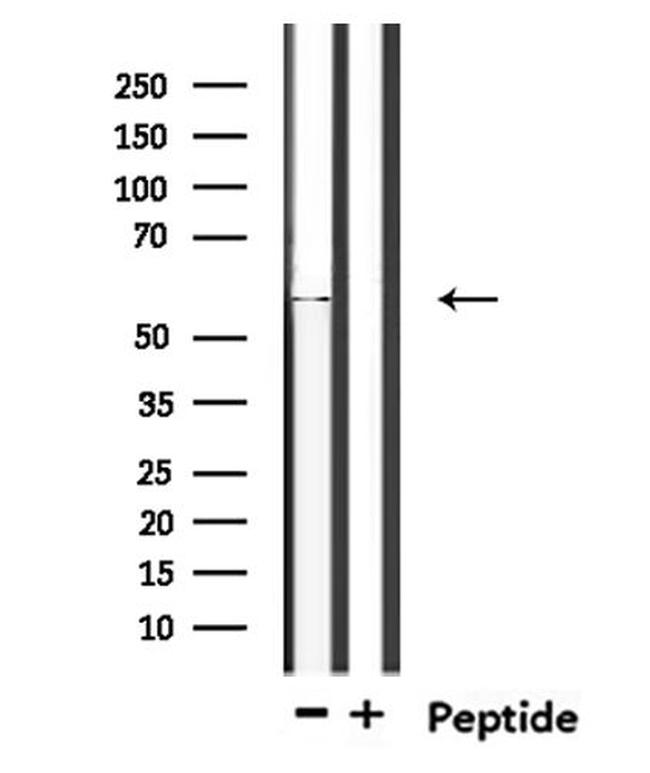 TIGD4 Antibody in Western Blot (WB)