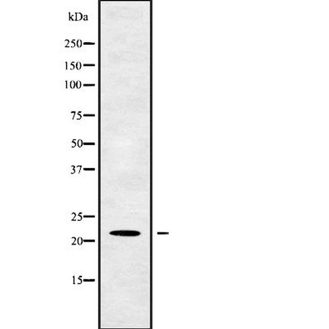 TM2D1 Antibody in Western Blot (WB)