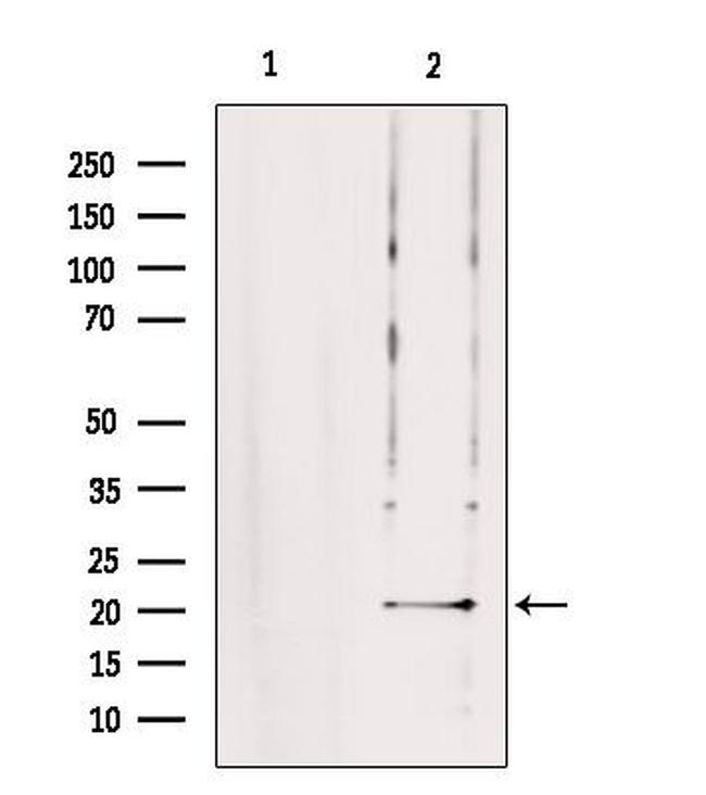 TRAPPC5 Antibody in Western Blot (WB)
