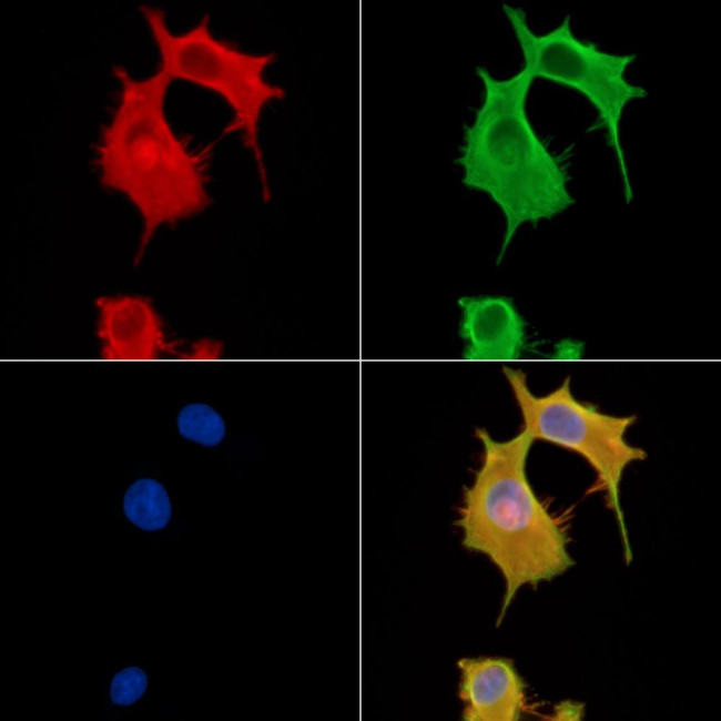 BTF3L4 Antibody in Immunocytochemistry (ICC/IF)
