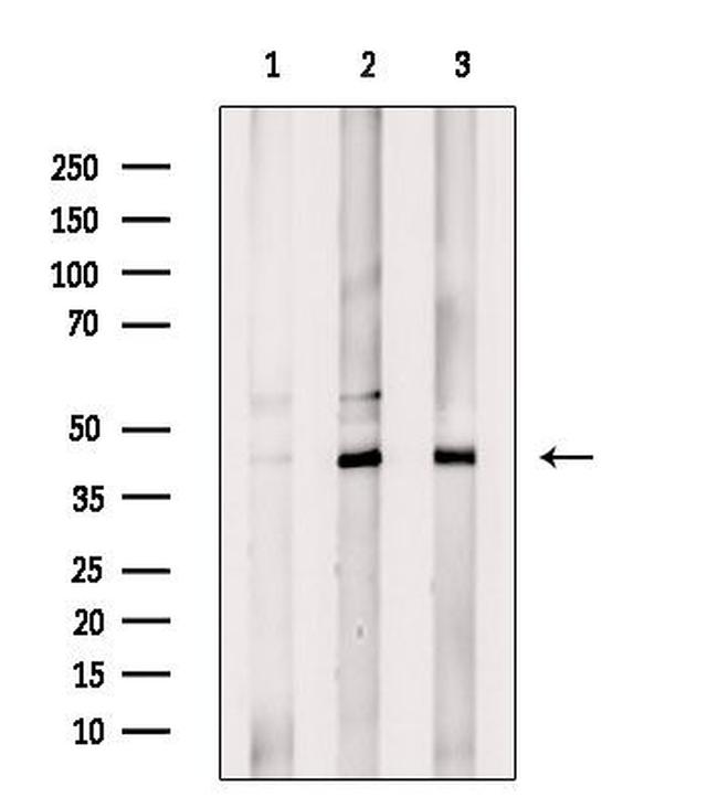 USP12 Antibody in Western Blot (WB)