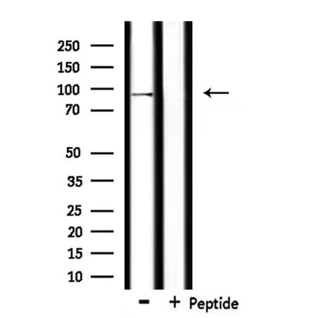 USP16 Antibody in Western Blot (WB)