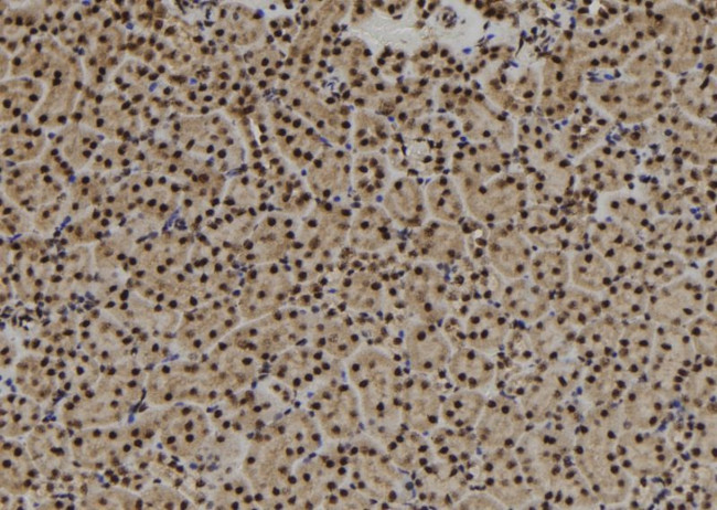 USP3 Antibody in Immunohistochemistry (Paraffin) (IHC (P))