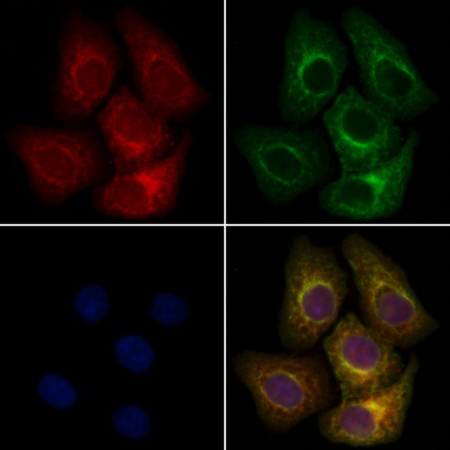 MEKK6 Antibody in Immunocytochemistry (ICC/IF)