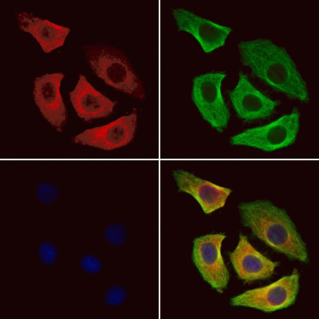 CDC25B Antibody in Immunocytochemistry (ICC/IF)