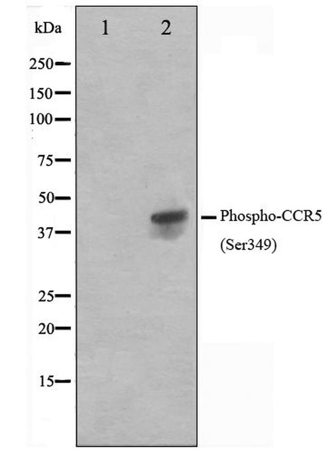 Phospho-CCR5 (Ser349) Antibody in Western Blot (WB)