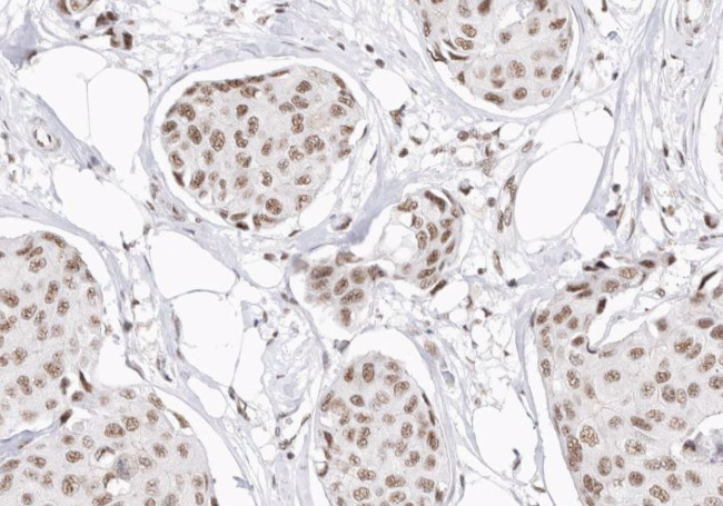 CDKN2B Antibody in Immunohistochemistry (Paraffin) (IHC (P))