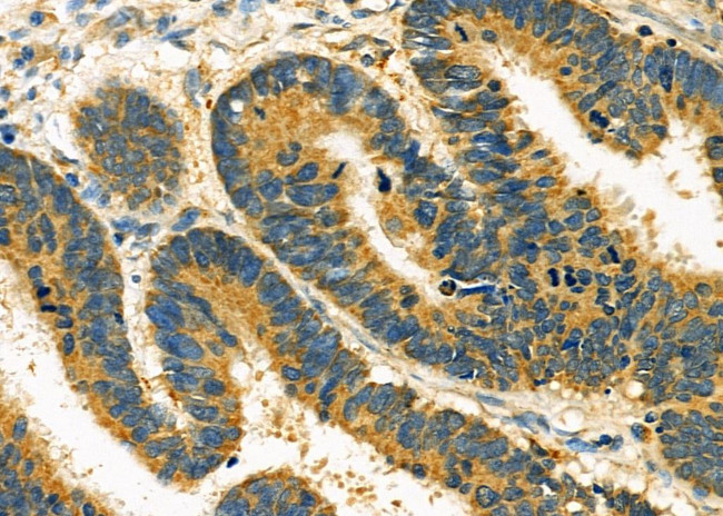 ANP32C Antibody in Immunohistochemistry (Paraffin) (IHC (P))