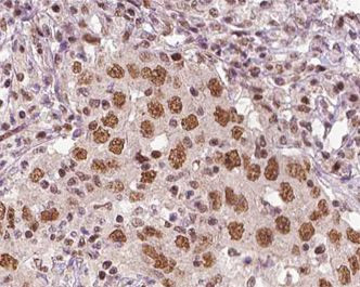 XRN2 Antibody in Immunohistochemistry (Paraffin) (IHC (P))