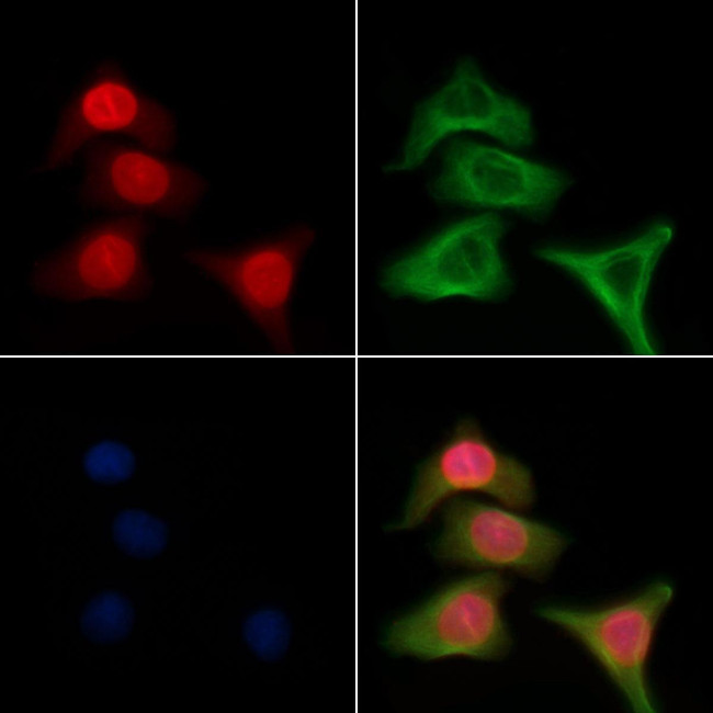 GTF2H2 Antibody in Immunocytochemistry (ICC/IF)