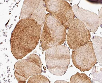 CDKN2C Antibody in Immunohistochemistry (Paraffin) (IHC (P))