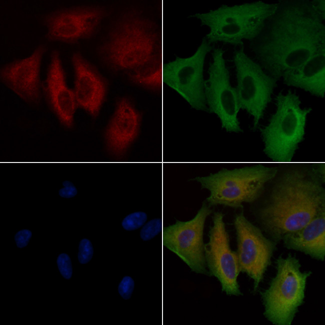 GPRIN1 Antibody in Immunocytochemistry (ICC/IF)