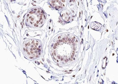 Phospho-Estrogen Receptor alpha (Ser104) Antibody in Immunohistochemistry (Paraffin) (IHC (P))