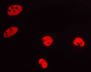 Phospho-Progesterone Receptor (Ser400) Antibody in Immunocytochemistry (ICC/IF)
