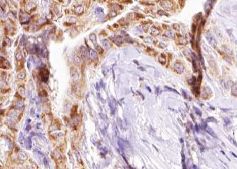 Phospho-BIK (Thr33) Antibody in Immunohistochemistry (Paraffin) (IHC (P))