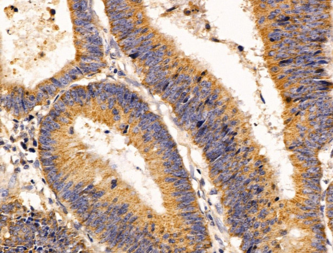 EFEMP2 Antibody in Immunohistochemistry (Paraffin) (IHC (P))
