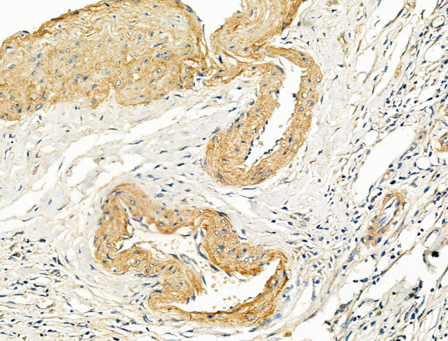 COL4A2 Antibody in Immunohistochemistry (Paraffin) (IHC (P))