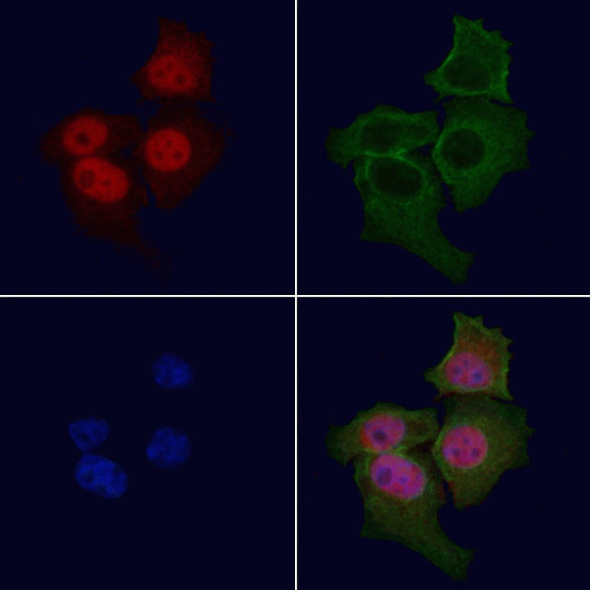 Bcr Antibody in Immunocytochemistry (ICC/IF)