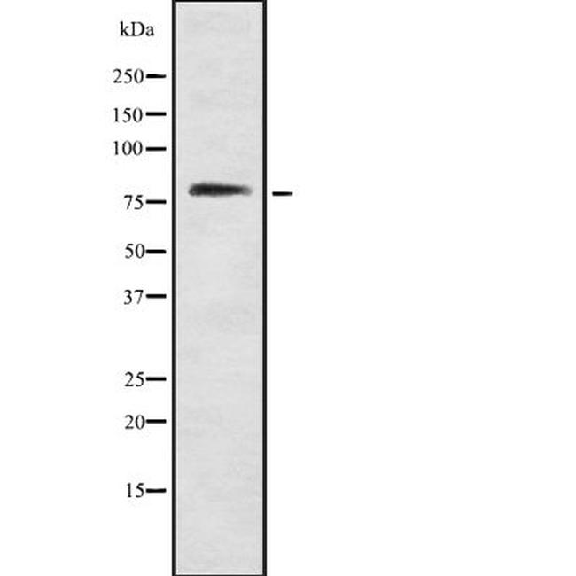 ARHGAP22 Antibody in Western Blot (WB)
