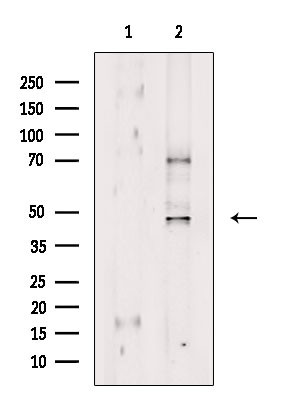 GPRIN2 Antibody in Western Blot (WB)