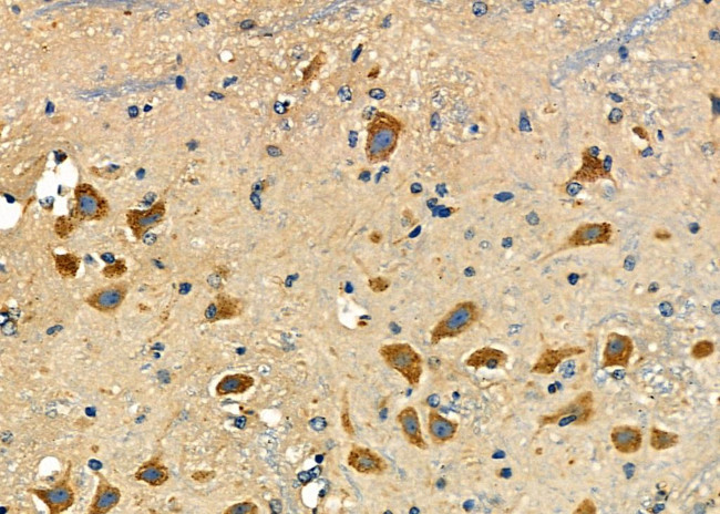 NCLN Antibody in Immunohistochemistry (Paraffin) (IHC (P))