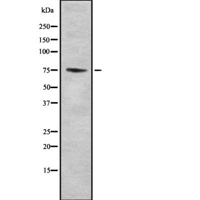 PDE10A Antibody in Western Blot (WB)
