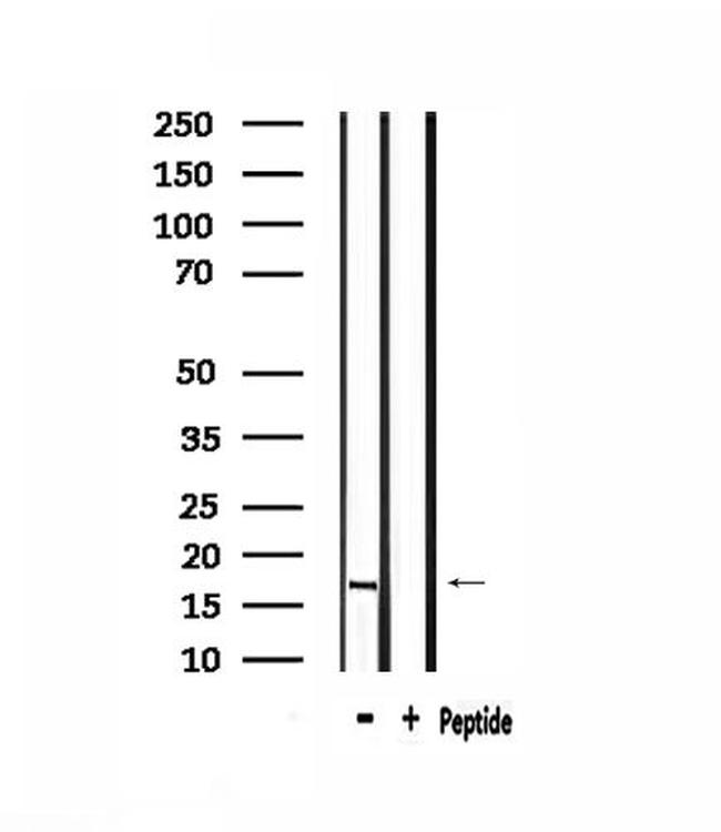RPS13 Antibody in Western Blot (WB)