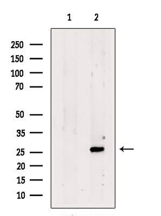 SCAND1 Antibody in Western Blot (WB)