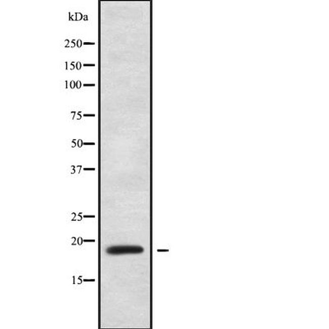 ZNF9 Antibody in Western Blot (WB)