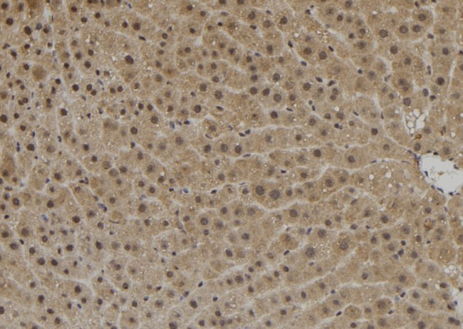 ZNF839 Antibody in Immunohistochemistry (Paraffin) (IHC (P))