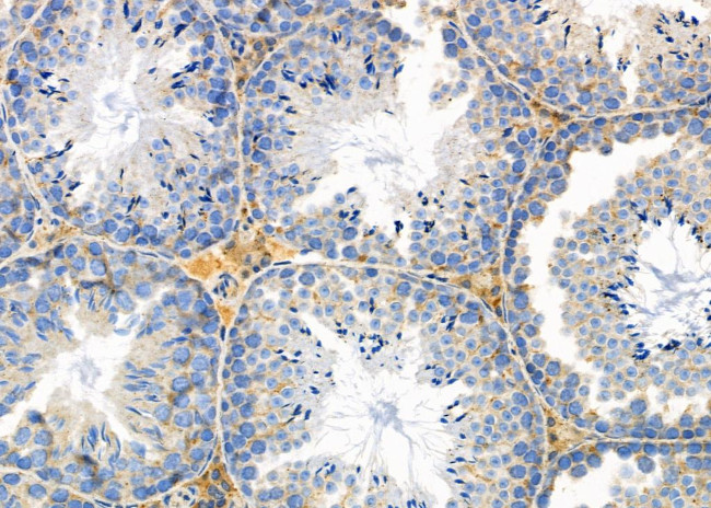 Cytokeratin 81/86 Antibody in Immunohistochemistry (Paraffin) (IHC (P))