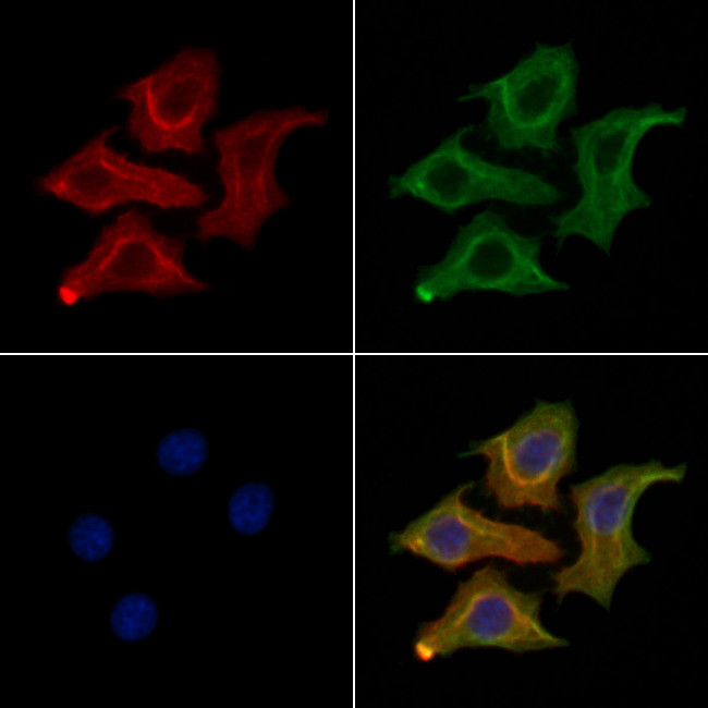 SIK2 Antibody in Immunocytochemistry (ICC/IF)