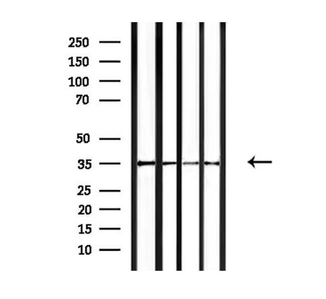 OR4F15 Antibody in Western Blot (WB)
