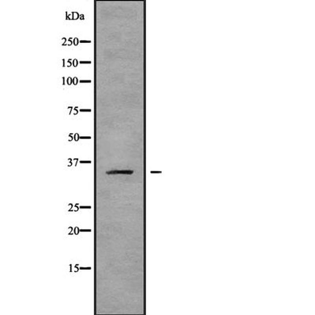 OR2B6 Antibody in Western Blot (WB)