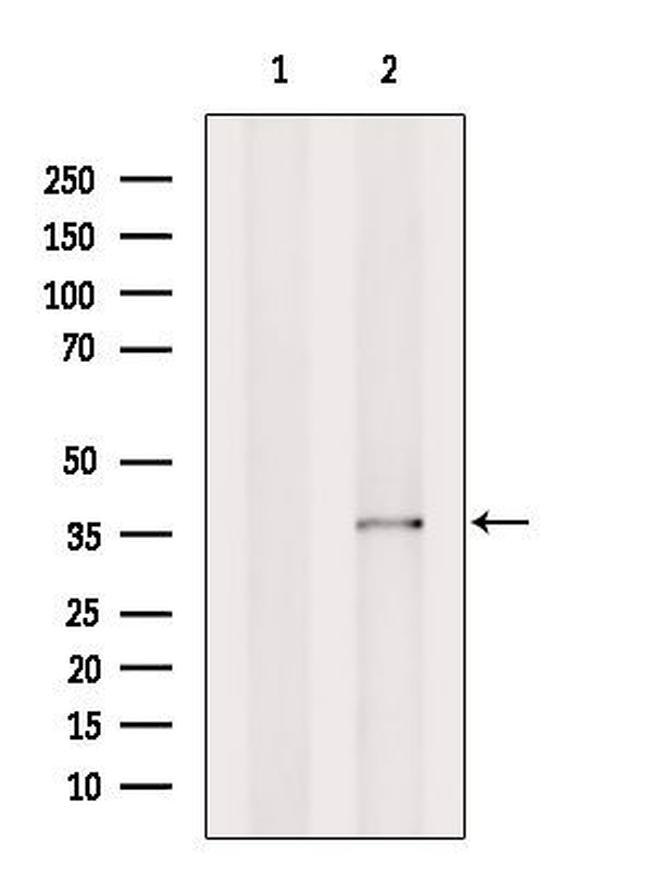 OR5L1/OR5L2 Antibody in Western Blot (WB)