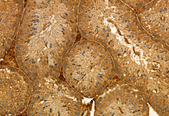 SQLE Antibody in Immunohistochemistry (Paraffin) (IHC (P))