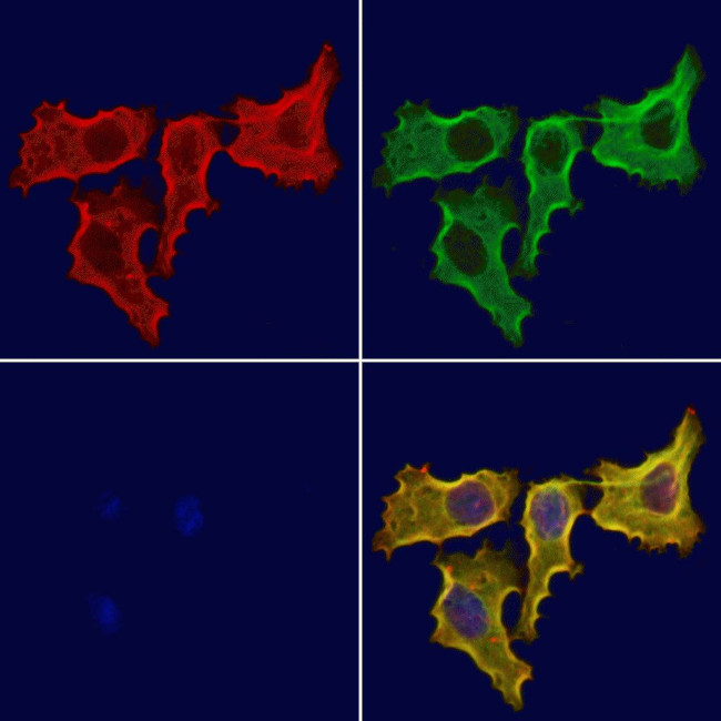 AP1M1 Antibody in Immunocytochemistry (ICC/IF)