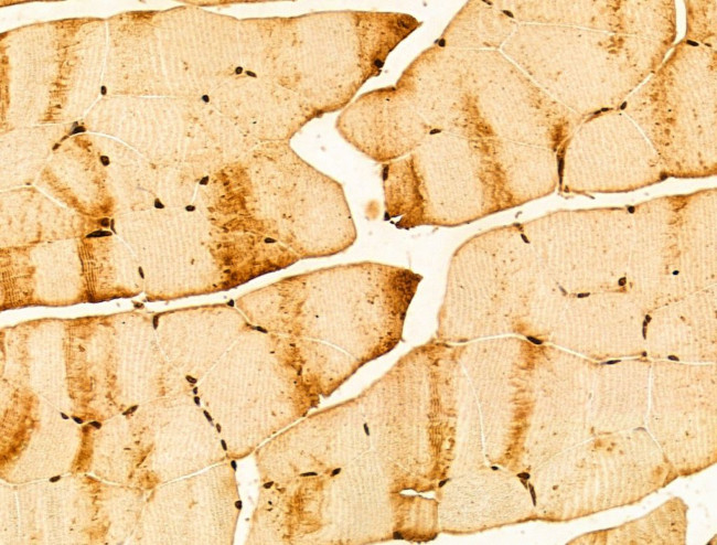 NOB1 Antibody in Immunohistochemistry (Paraffin) (IHC (P))