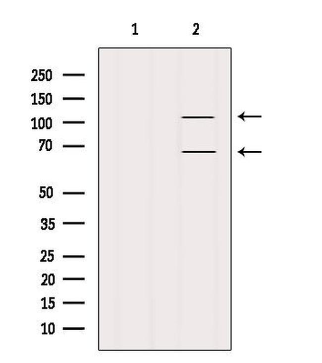 FAM65B Antibody in Western Blot (WB)