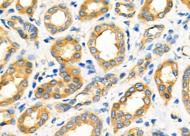 PDHX Antibody in Immunohistochemistry (Paraffin) (IHC (P))