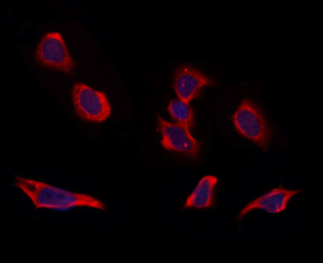 RIC8B Antibody in Immunocytochemistry (ICC/IF)