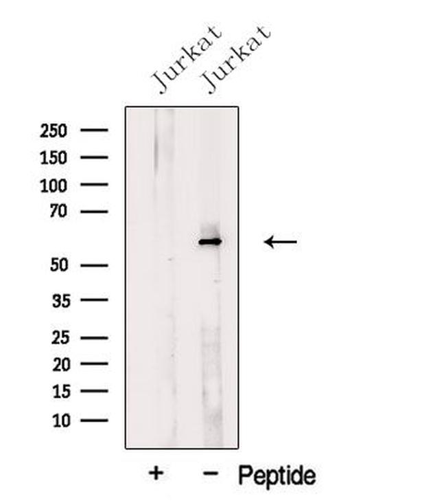 WHSC2 Antibody in Western Blot (WB)