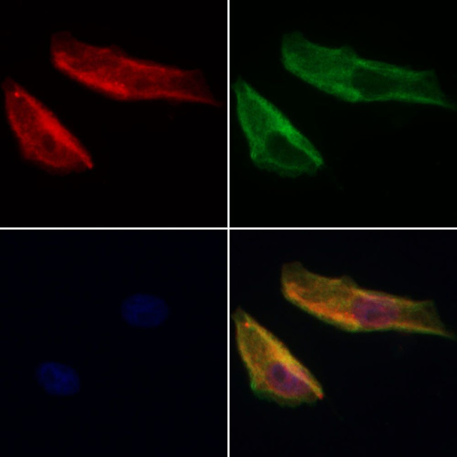 PDLIM3 Antibody in Immunocytochemistry (ICC/IF)