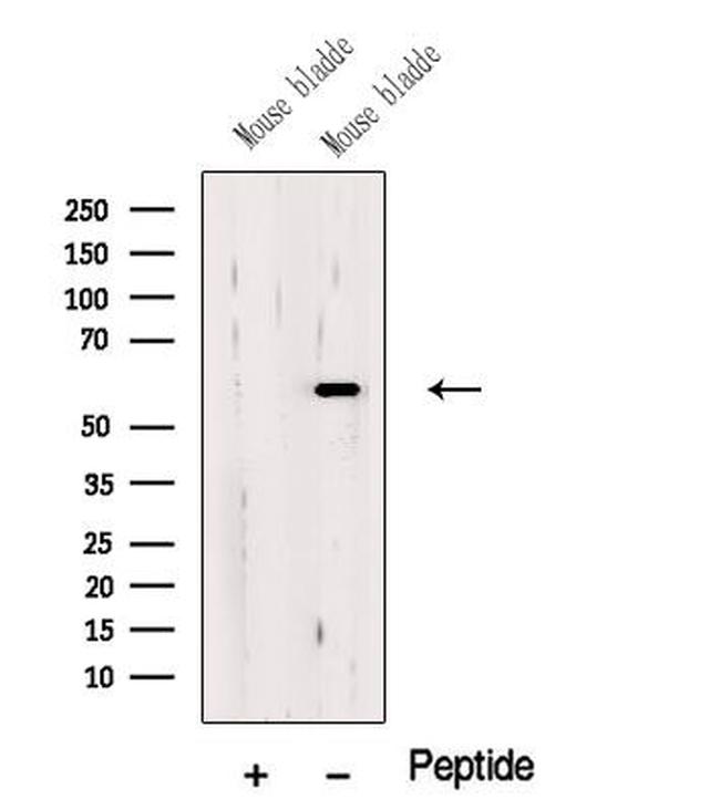 OSGIN1 Antibody in Western Blot (WB)