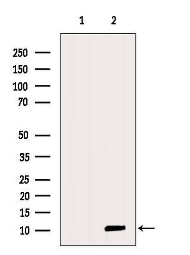FAM195A Antibody in Western Blot (WB)