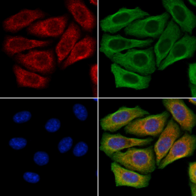 FUT6 Antibody in Immunocytochemistry (ICC/IF)