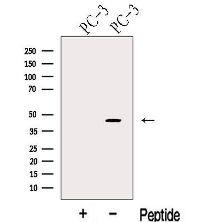 KLF6 Antibody in Western Blot (WB)